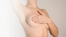 Haartransplantation,haartransplantation türkei​ - Startseite