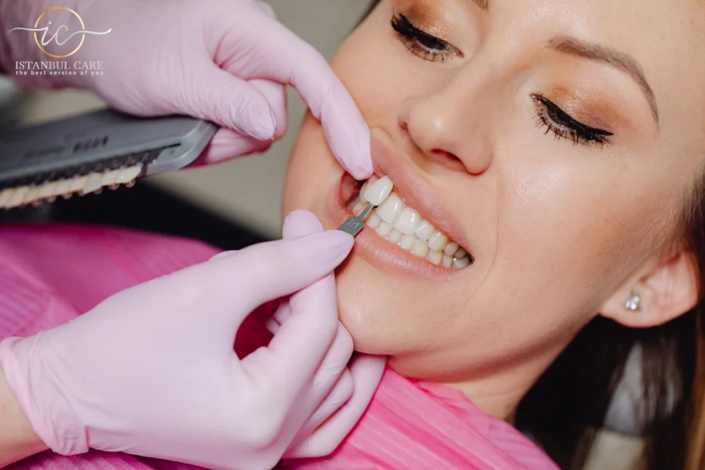 E-max Veneers in Turkey,E-max Veneers - E-max Veneers in Turkey: Quality Results at Great Prices E-Max Veneers in Turkey Price
