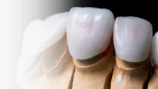 Haartransplantation,haartransplantation türkei​ - Startseite