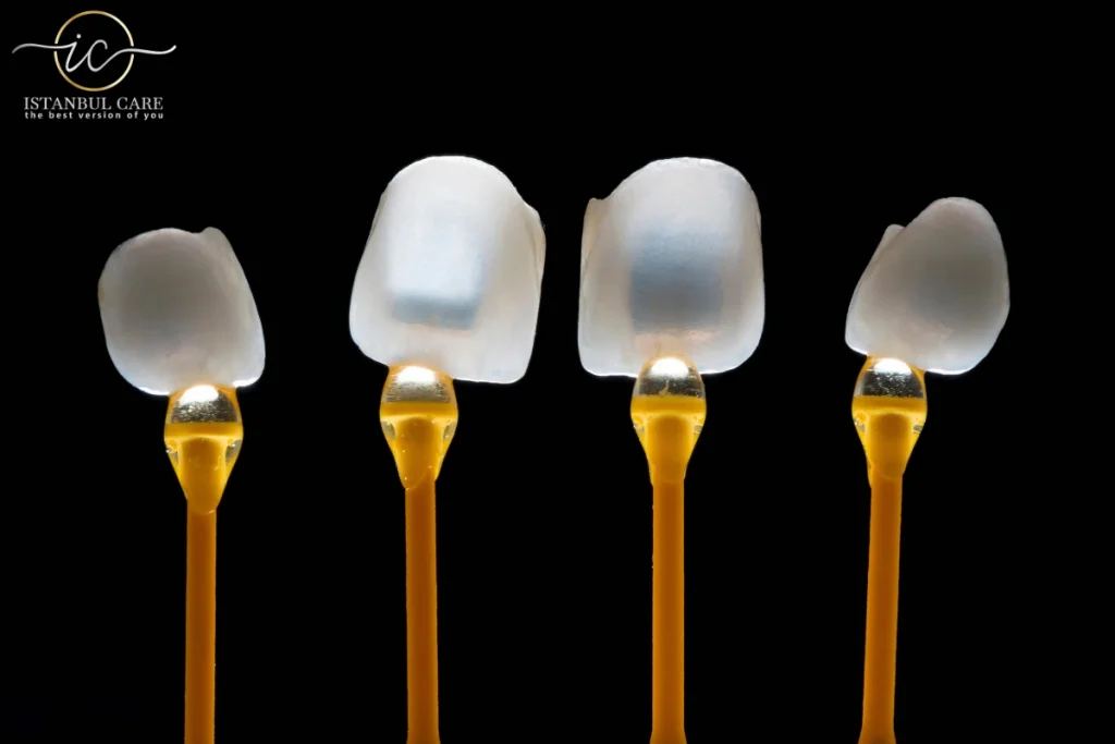 E-max Veneers in Turkey,E-max Veneers - E-max Veneers in Turkey: Quality Results at Great Prices E-max Veneers in Turkey,E-max Veneers - E-max Veneers in Turkey: Quality Results at Great Prices