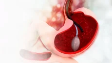 Haartransplantation,haartransplantation türkei​ - Startseite