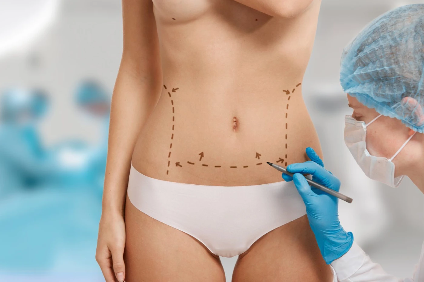 mega-liposuction-turkey-istanbul-care mega liposuction turkey istanbul-care