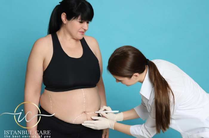 plus-size-liposuction-in-turkey liposuction surgery in turkey