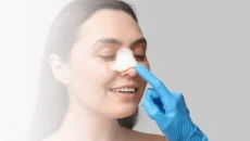 Haartransplantation,haartransplantation türkei​ - Startseite