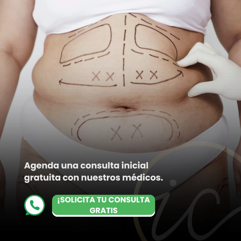 Mega liposucción - Mega liposucción en Turquía