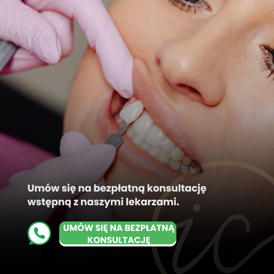 Licówki E-max w Turcji - Licówki E-max w Turcji