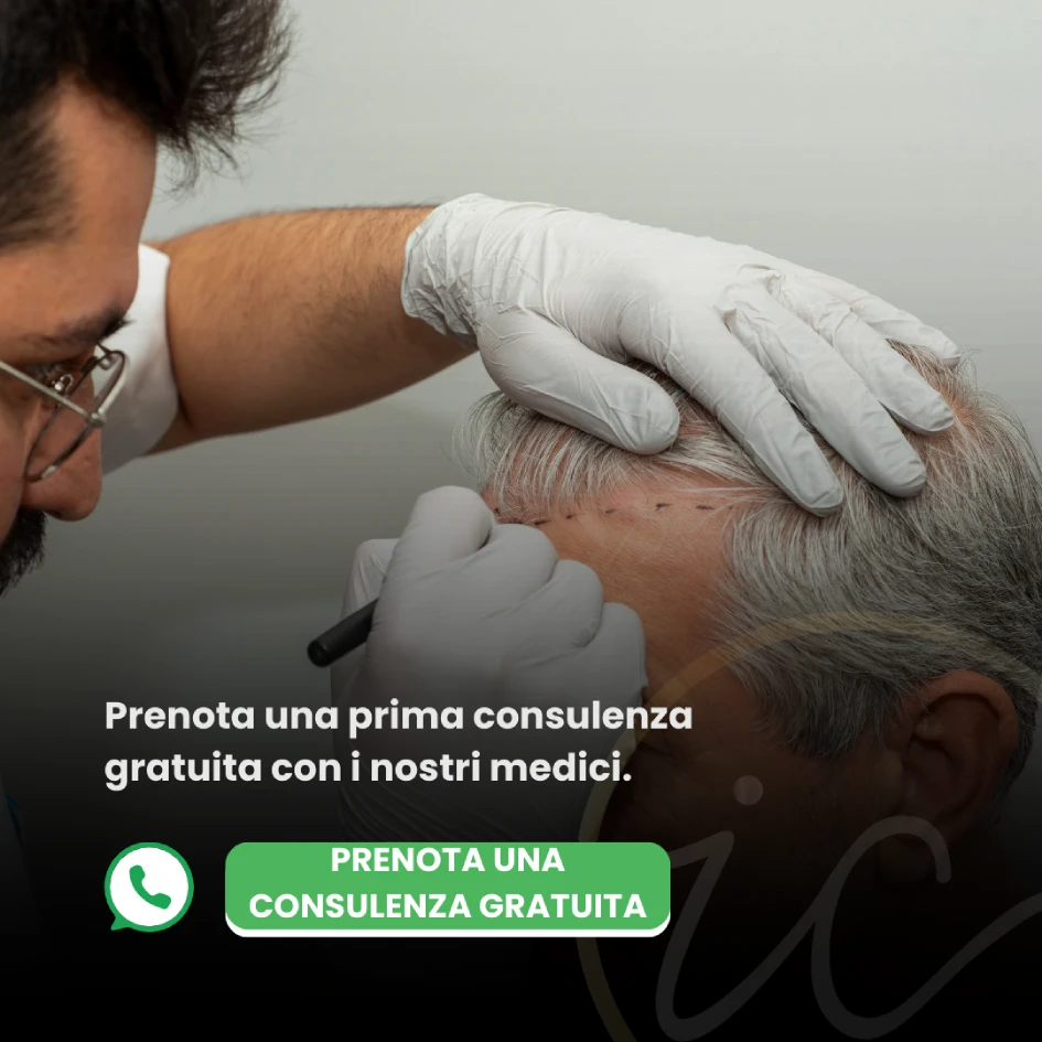 Trapianto di capelli in Turchia,Trapianto di capelli,Trapianto di capelli FUE - Trapianto di capelli FUE in Turchia
