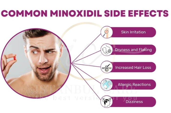 Minoxidil warnings Minoxidil warnings