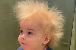 Spun-glass hair