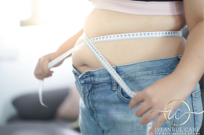 gastric bypass Turkey surgery